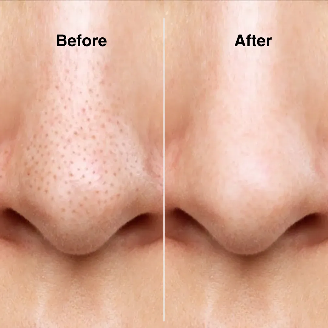 imgi_87_glowfacial-beforeafter1