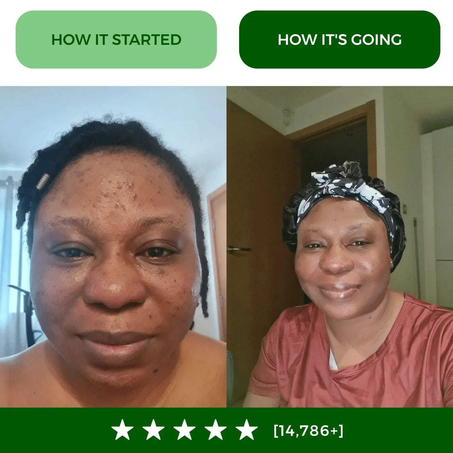 imgi_191_before-after_4_68fb4bcb-38e9-47a9-958f-df16aad6011a