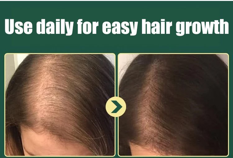 Rosemary Keratin Herbal Repair Shampoo 7
