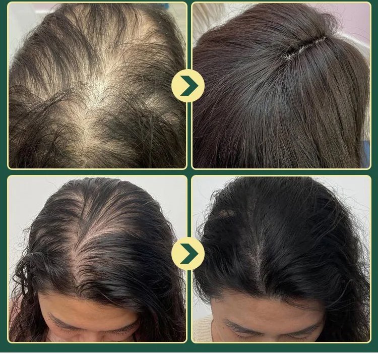 Rosemary Keratin Herbal Repair Shampoo 8