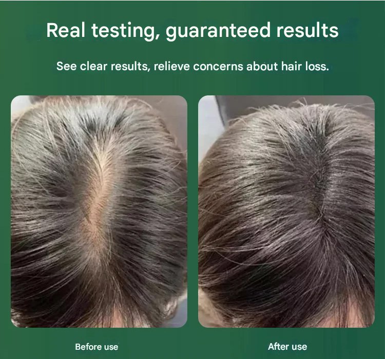 Rosemary Keratin Herbal Repair Shampoo 10