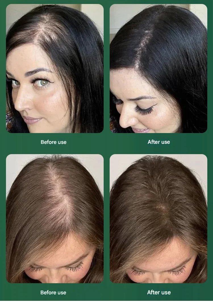 Rosemary Keratin Herbal Repair Shampoo 11